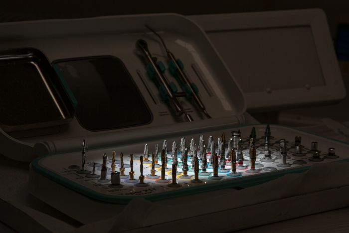 Zubní implantáty fotka