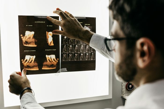 Zubní implantáty fotka