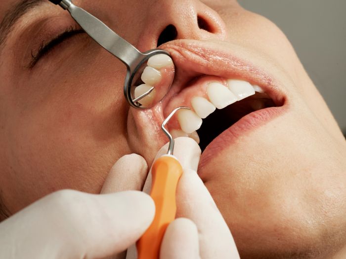 Zubní implantáty fotka